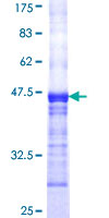 ab159072 on a 12.5% SDS-PAGE stained with Coomassie Blue.