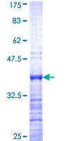 ab159073 on a 12.5% SDS-PAGE stained with Coomassie Blue.