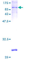 ab159074 on a 12.5% SDS-PAGE stained with Coomassie Blue.