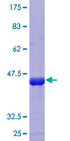ab159075 on a 12.5% SDS-PAGE stained with Coomassie Blue.
