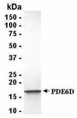 SDS-PAGE analysis of PDE6D recombinant protein. 4-20% SDS gradient gel. Coomassie blue staining. Observed band size 17kDa.