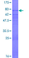 ab152598 on a 12.5% SDS-PAGE stained with Coomassie Blue.
