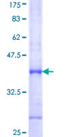 ab152599 on a 12.5% SDS-PAGE stained with Coomassie Blue.