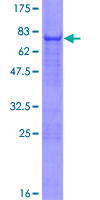 ab162082 on a 12.5% SDS-PAGE stained with Coomassie Blue.