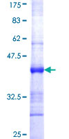 ab162083 on a 12.5% SDS-PAGE stained with Coomassie Blue.