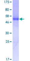 12.5% SDS-PAGE analysis of ab132929 stained with Coomassie Blue