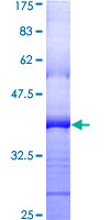 ab159082 on a 12.5% SDS-PAGE stained with Coomassie Blue.