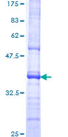 ab159081 on a 12.5% SDS-PAGE stained with Coomassie Blue.