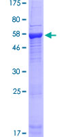ab165588 on a 12.5% SDS-PAGE stained with Coomassie Blue.