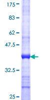 ab165589 on a 12.5% SDS-PAGE stained with Coomassie Blue.