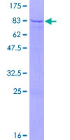 ab161215 on a 12.5% SDS-PAGE stained with Coomassie Blue.