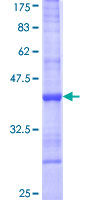 ab161216 on a 12.5% SDS-PAGE stained with Coomassie Blue.