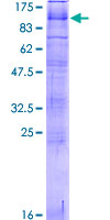 ab160302 on a 12.5% SDS-PAGE stained with Coomassie Blue.
