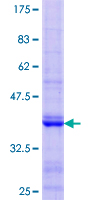 ab160303 on a 12.5% SDS-PAGE stained with Coomassie Blue.