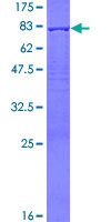 ab160403 on a 12.5% SDS-PAGE stained with Coomassie Blue.