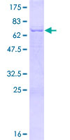 ab163484 on a 12.5% SDS-PAGE stained with Coomassie Blue.