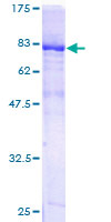 ab164137 on a 12.5% SDS-PAGE stained with Coomassie Blue.