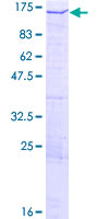 ab162285 on a 12.5% SDS-PAGE stained with Coomassie Blue.