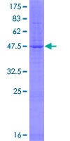ab160972 on a 12.5% SDS-PAGE stained with Coomassie Blue.