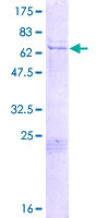 ab161530 on a 12.5% SDS-PAGE stained with Coomassie Blue.
