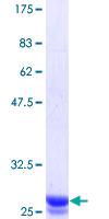 ab161454 on a 12.5% SDS-PAGE stained with Coomassie Blue.