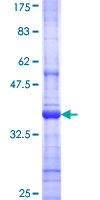 ab159101 on a 12.5% SDS-PAGE stained with Coomassie Blue.