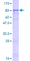 ab114201 on 12.5% SDS-PAGE stained with Coomassie Blue.