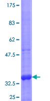 12.5% SDS-PAGE showing ab112345 at approximately 36.08kDa stained with Coomassie Blue.