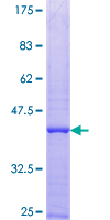 ab161663 on a 12.5% SDS-PAGE stained with Coomassie Blue.