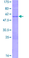 ab162827 on a 12.5% SDS-PAGE stained with Coomassie Blue.