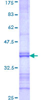 ab162828 on a 12.5% SDS-PAGE stained with Coomassie Blue.