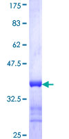 ab159088 on a 12.5% SDS-PAGE stained with Coomassie Blue.