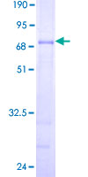 ab159092 on a 12.5% SDS-PAGE stained with Coomassie Blue.