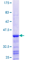 ab159093 on a 12.5% SDS-PAGE stained with Coomassie Blue.