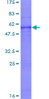 ab159291 on a 12.5% SDS-PAGE stained with Coomassie Blue.