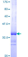 ab159292 on a 12.5% SDS-PAGE stained with Coomassie Blue.