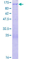 ab159089 on a 12.5% SDS-PAGE stained with Coomassie Blue.