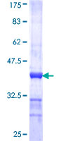 ab159090 on a 12.5% SDS-PAGE stained with Coomassie Blue.