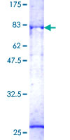 ab159098 on a 12.5% SDS-PAGE stained with Coomassie Blue.