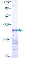 ab159099 on a 12.5% SDS-PAGE stained with Coomassie Blue.