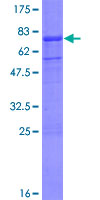ab159100 on a 12.5% SDS-PAGE stained with Coomassie Blue.