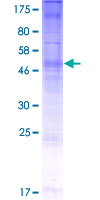 ab164935 on a 12.5% SDS-PAGE stained with Coomassie Blue.