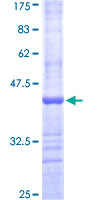 ab158620 on a 12.5% SDS-PAGE stained with Coomassie Blue.
