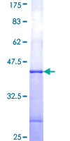 ab158613 on a 12.5% SDS-PAGE stained with Coomassie Blue.