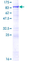 ab166124 on a 12.5% SDS-PAGE stained with Coomassie Blue.