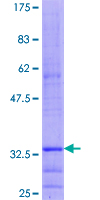ab160284 on a 12.5% SDS-PAGE stained with Coomassie Blue.