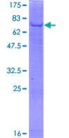 ab160511 on a 12.5% SDS-PAGE stained with Coomassie Blue.