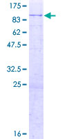 ab165977 on a 12.5% SDS-PAGE stained with Coomassie Blue.