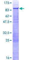 ab165101 on a 12.5% SDS-PAGE stained with Coomassie Blue.