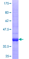ab165102 on a 12.5% SDS-PAGE stained with Coomassie Blue.
